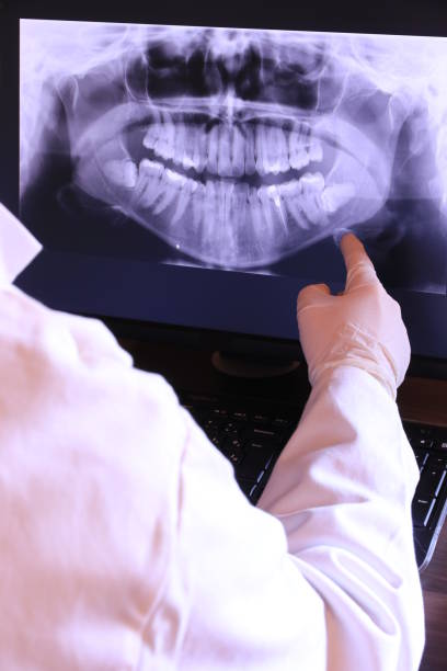 Best Broken or Cracked Tooth Emergency Dentist in Warm Springs, CA